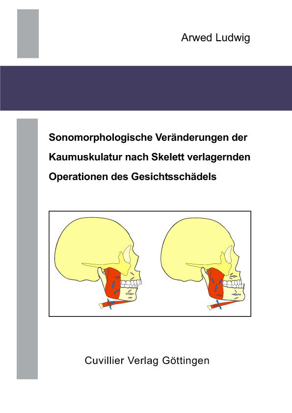 Sonomorphologische Veränderungen der Kaumuskulatur nach Skelett verlagernden Operationen des Gesichtsschädels