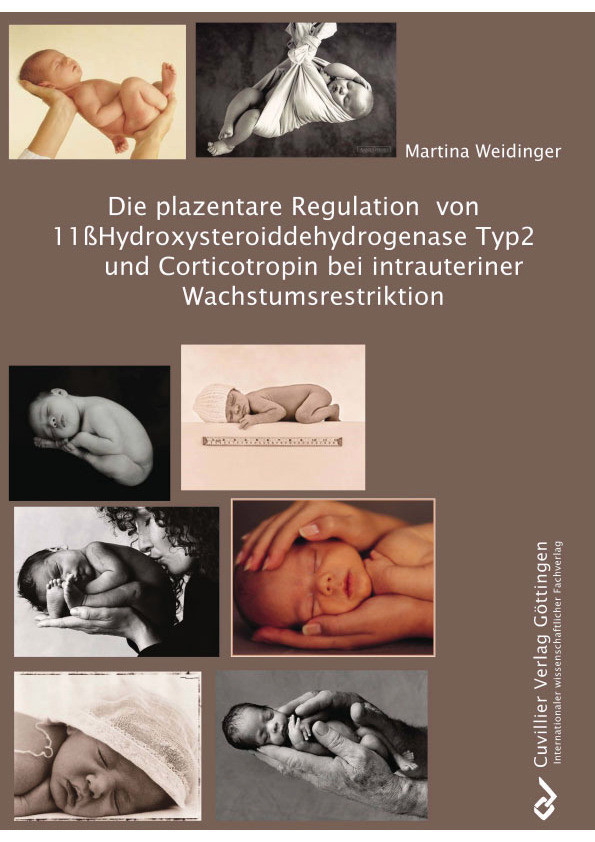 Cover Die plazentare Regulation von 11ßHydroxysteroiddehydrogenase Typ2 und Corticotropin bei intrauteriner Wachstumsrestriktion