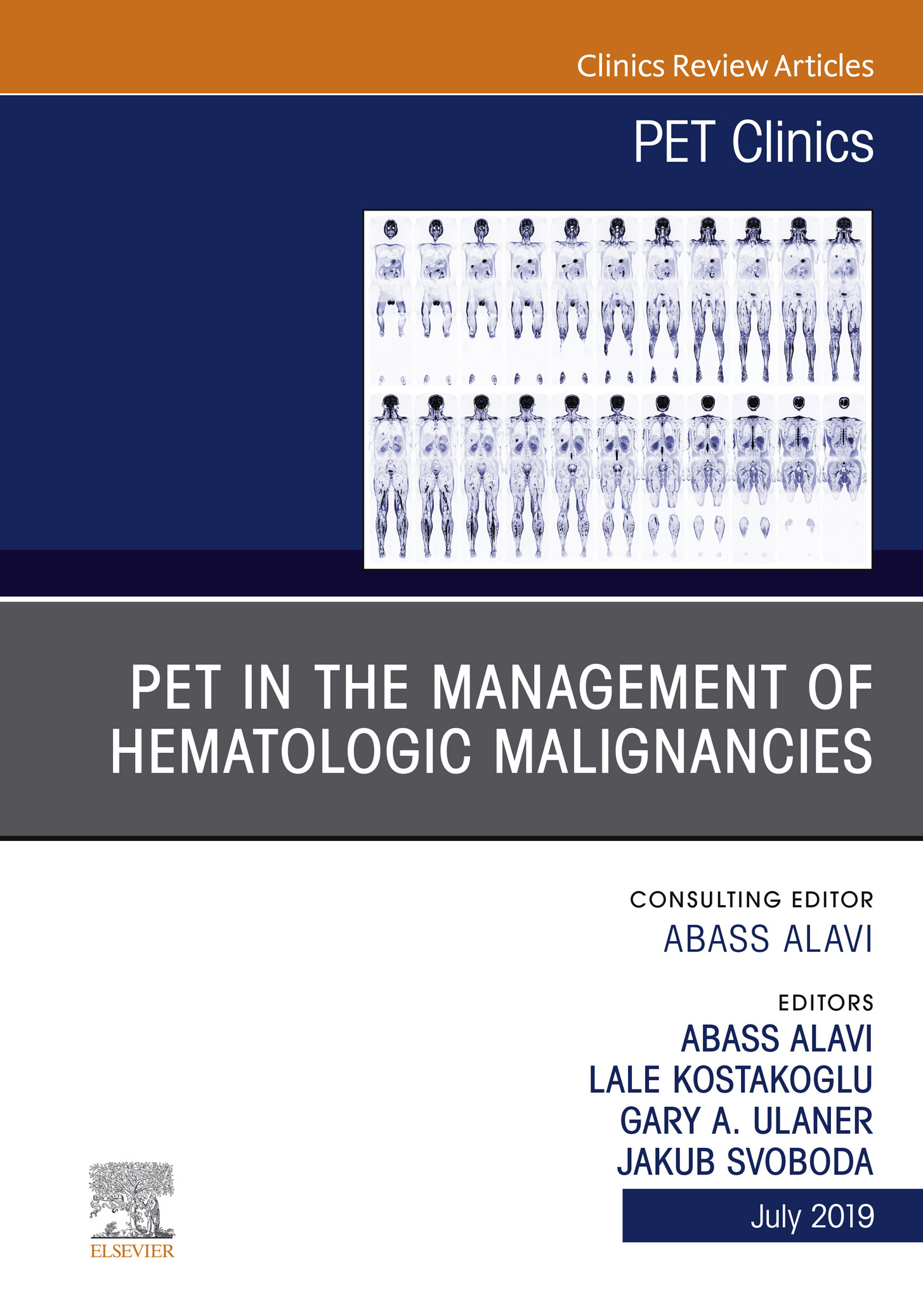 PET in the Management of Hematologic Malignancies, An Issue of PET Clinics, E-Book