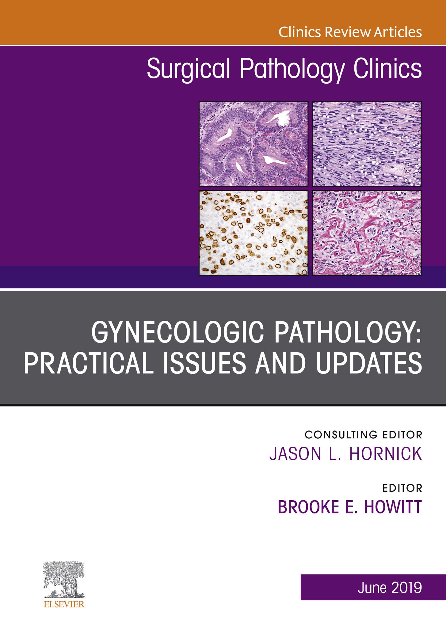 Gynecologic Pathology:  Practical Issues and Updates, An Issue of Surgical Pathology Clinics, Ebook