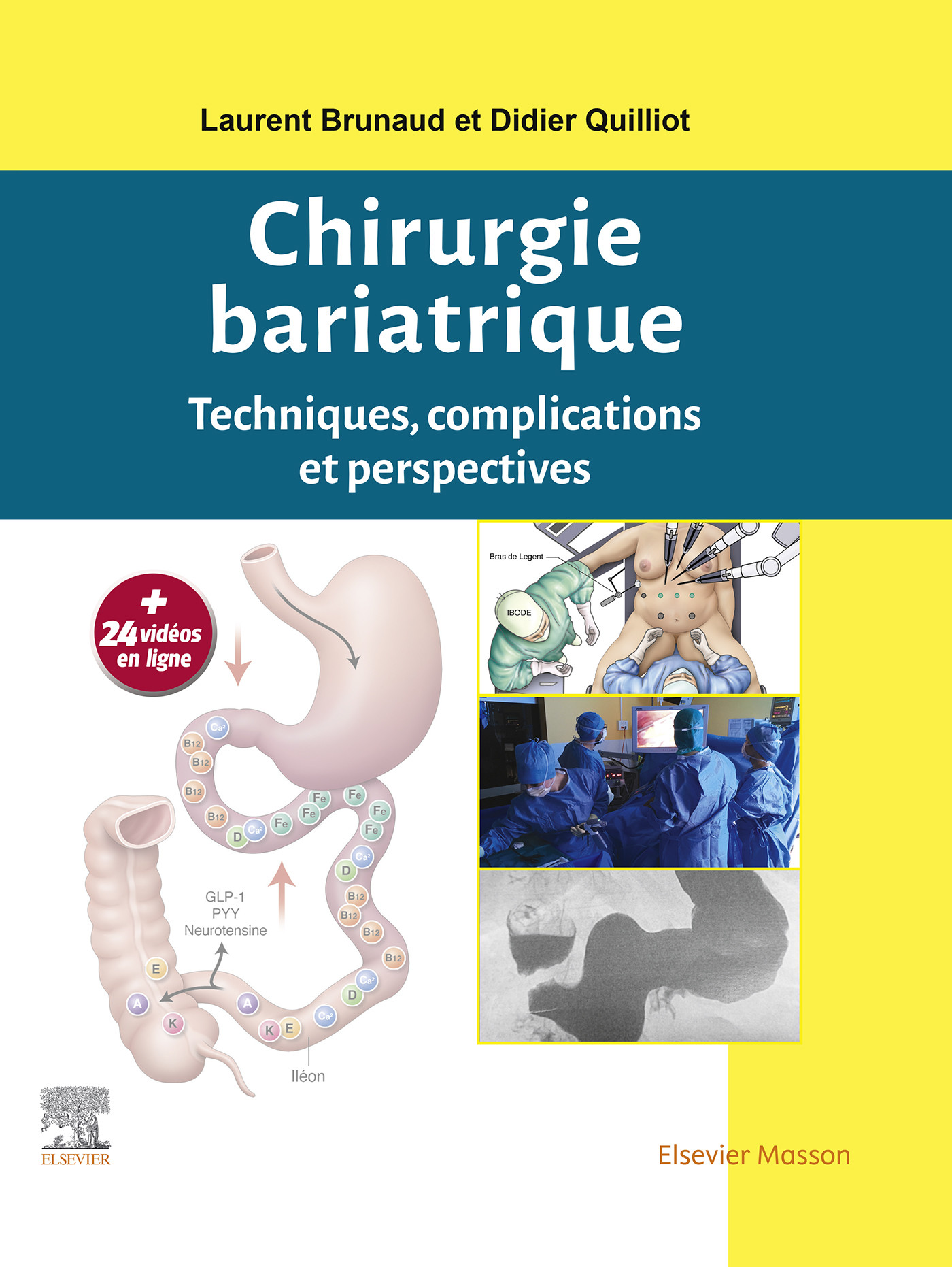 Chirurgie bariatrique