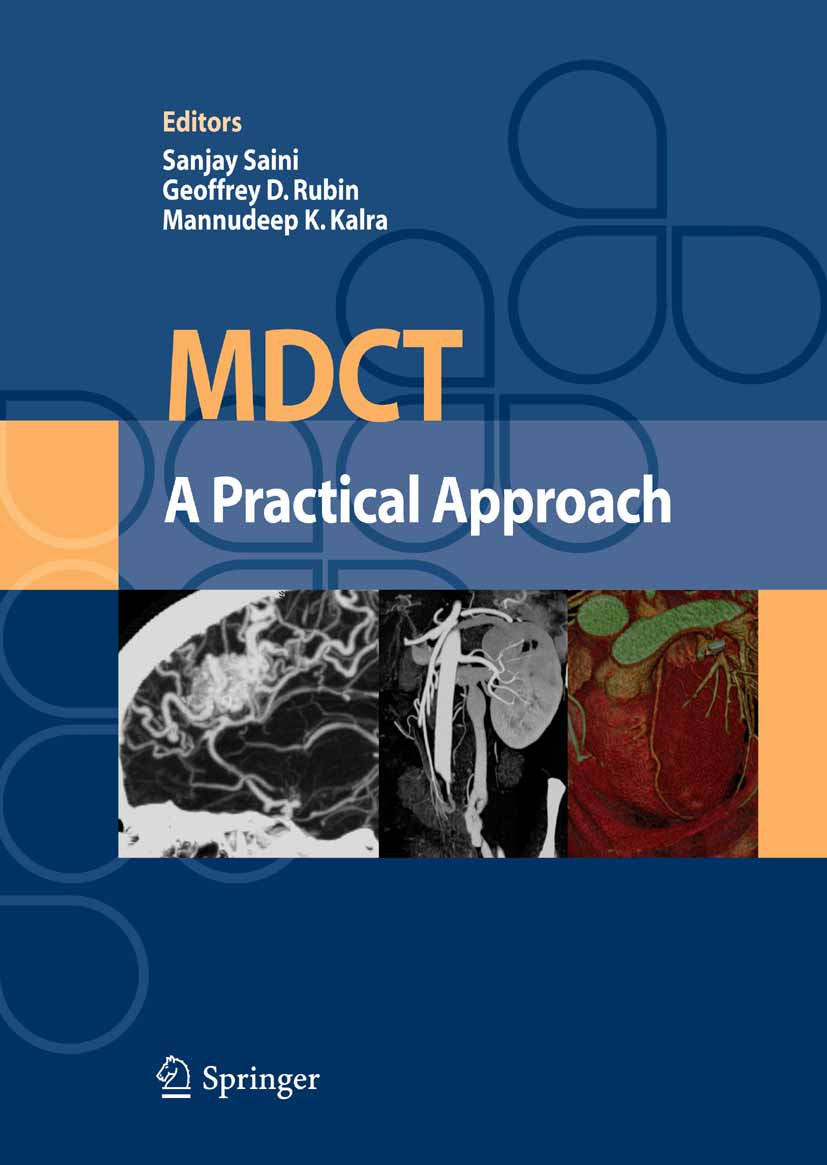 MDCT: A Practical Approach