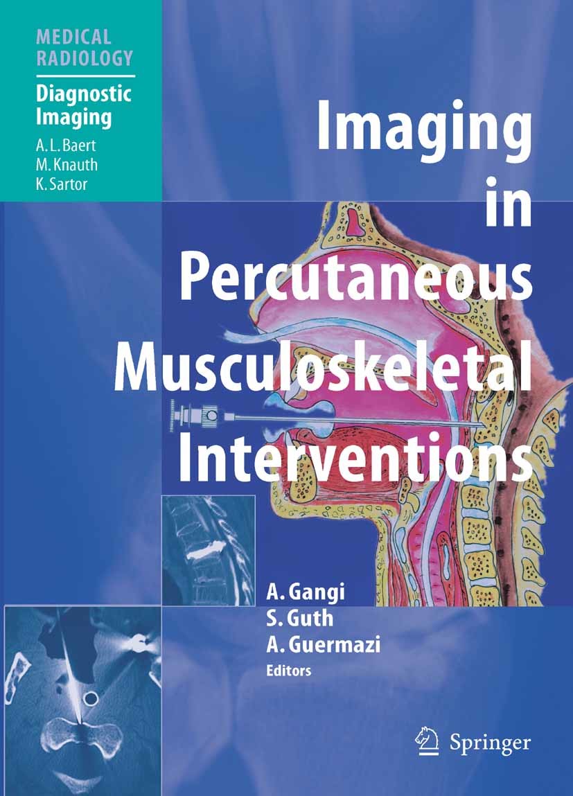 Cover Imaging in Percutaneous Musculoskeletal Interventions