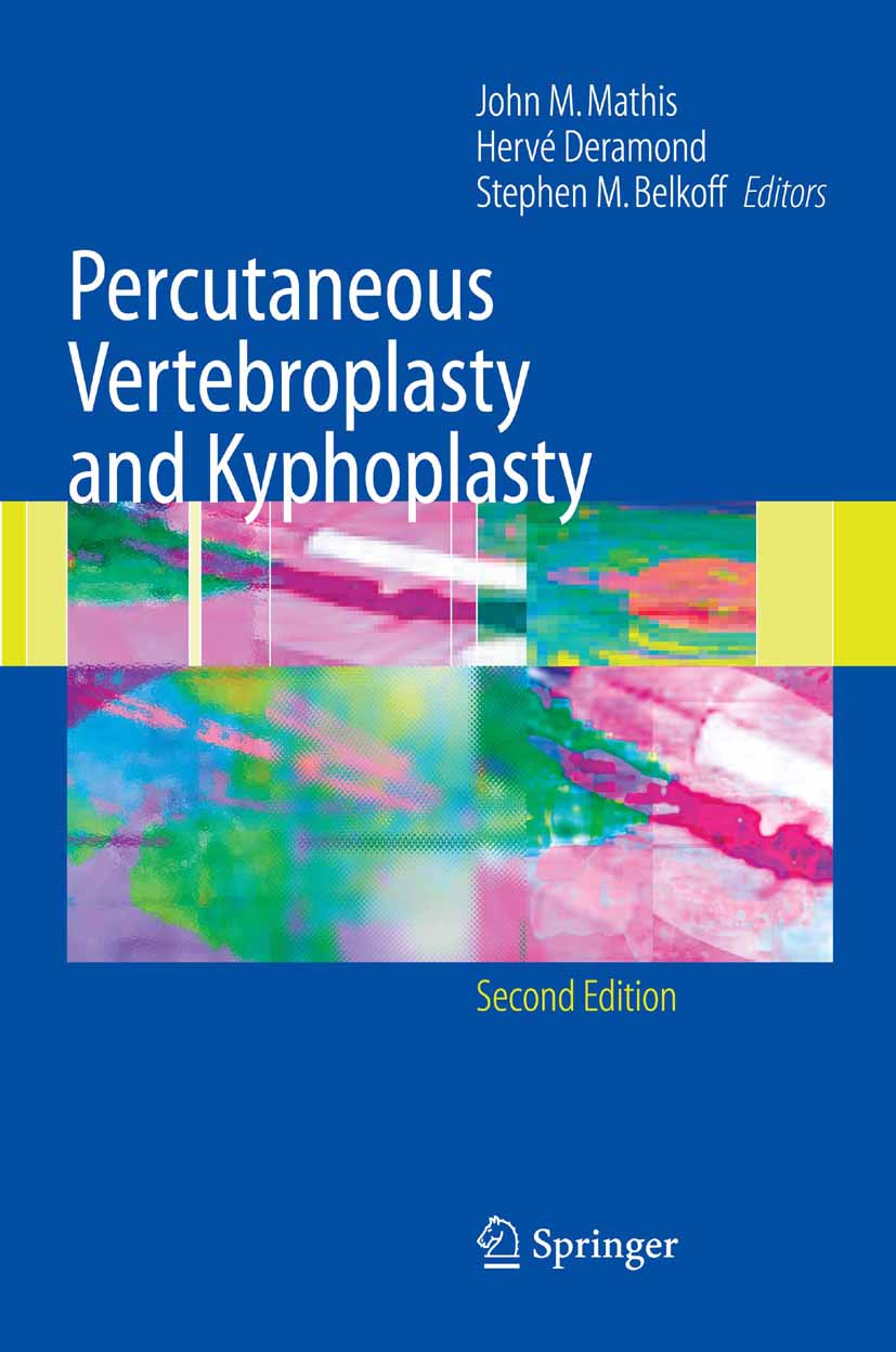 Cover Percutaneous Vertebroplasty and Kyphoplasty