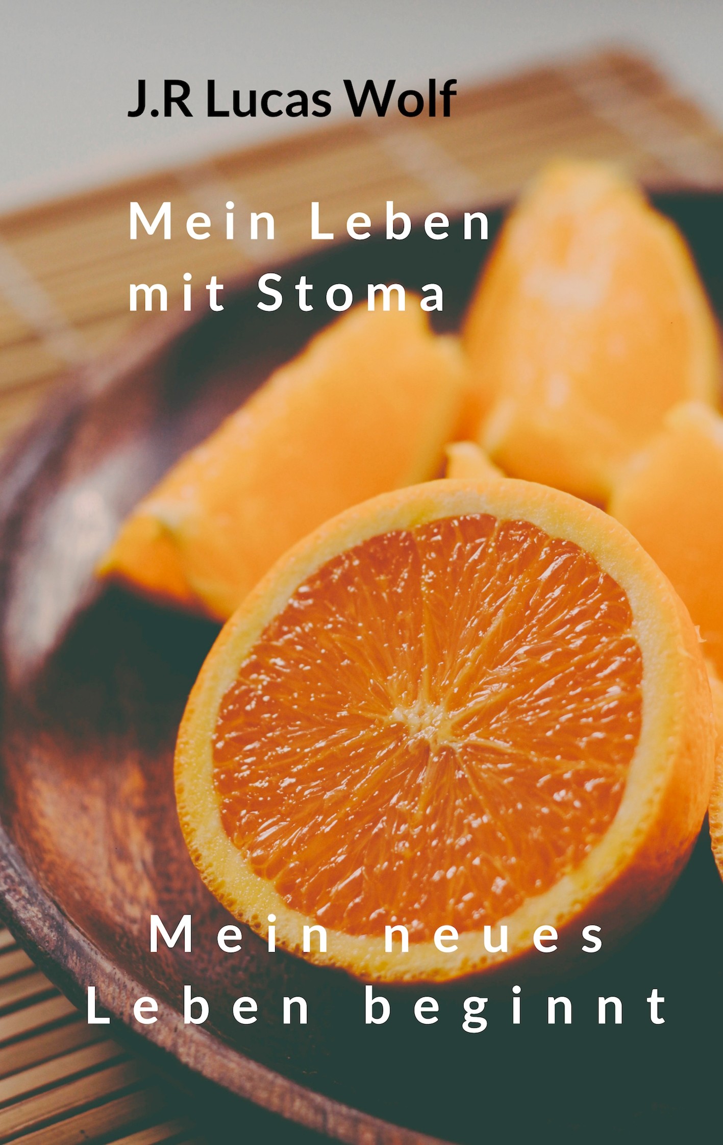 Cover Mein Leben mit Stoma