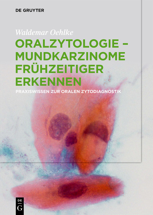 Cover Oralzytologie - Mundkarzinome frühzeitiger erkennen
