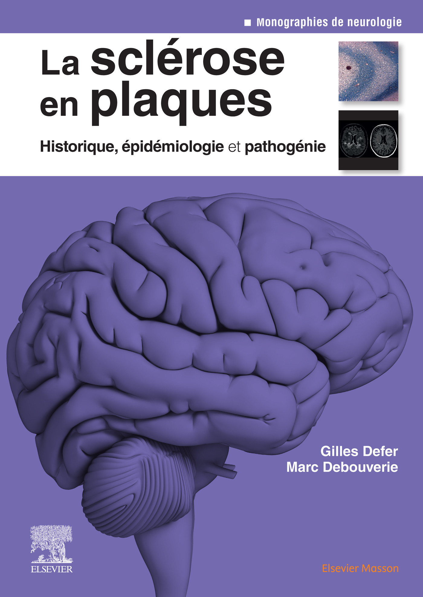Cover La sclérose en plaques - Historique, épidémiologie et pathogénie