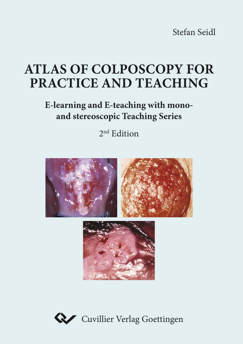 Atlas of Colposcopy for Practice and Teaching