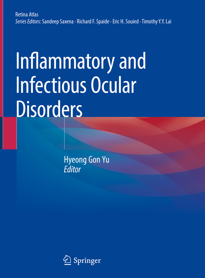Cover Inflammatory and Infectious Ocular Disorders