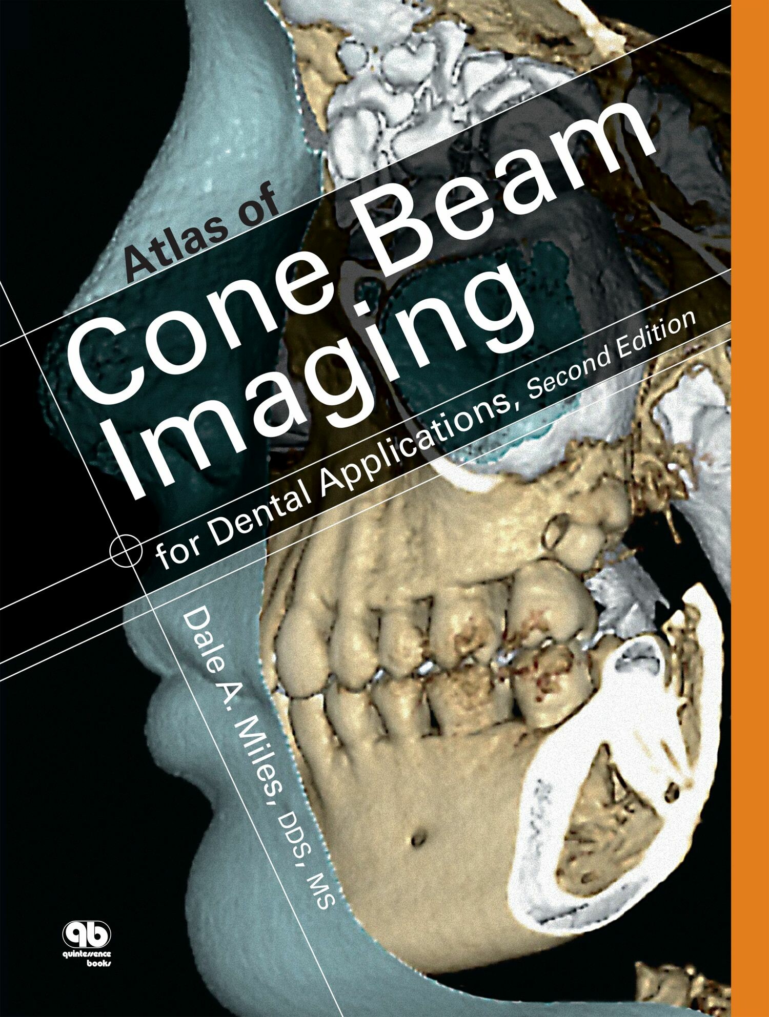 Cover Atlas of Cone Beam Imaging for Dental Applications