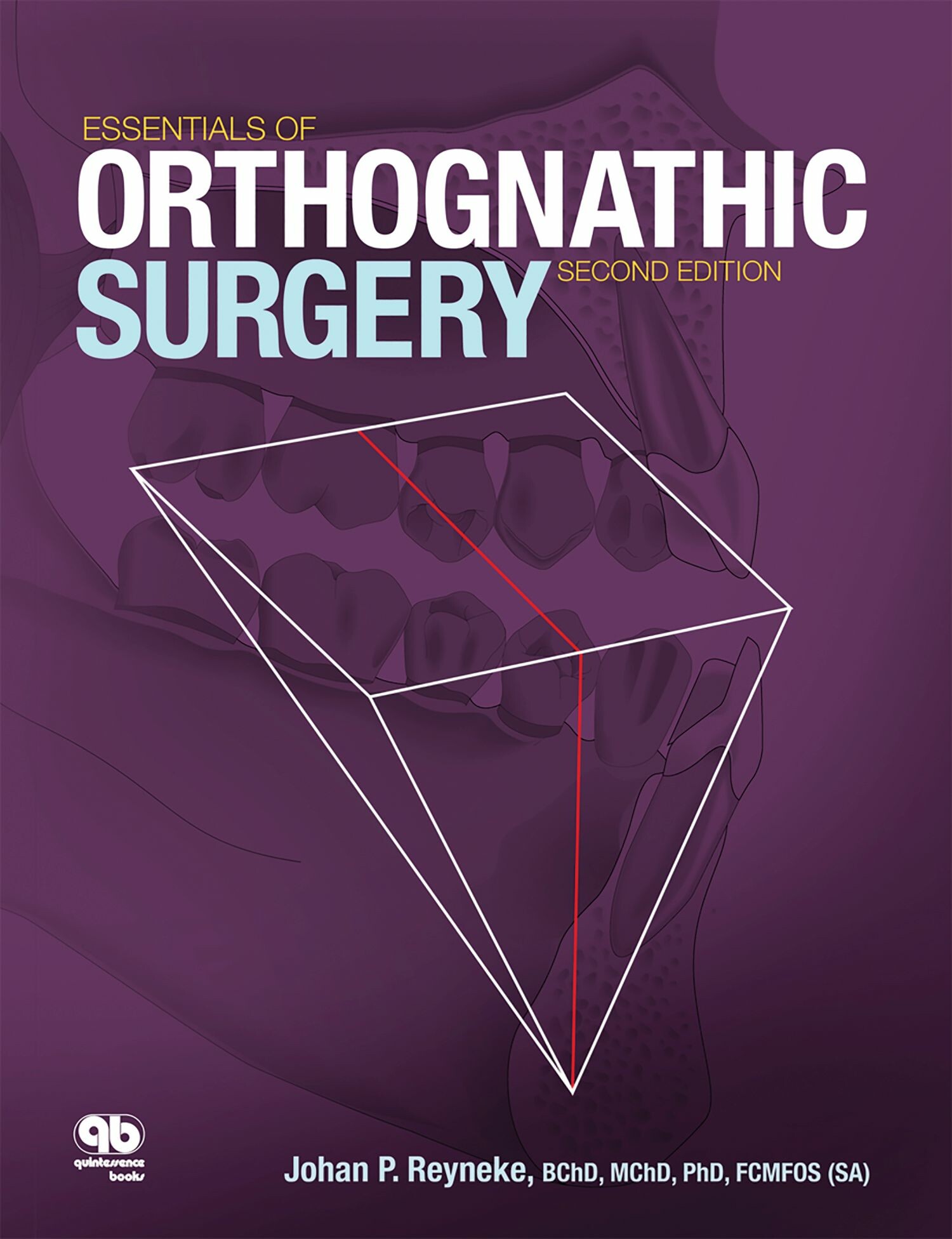 Cover Essentials of Orthognathic Surgery