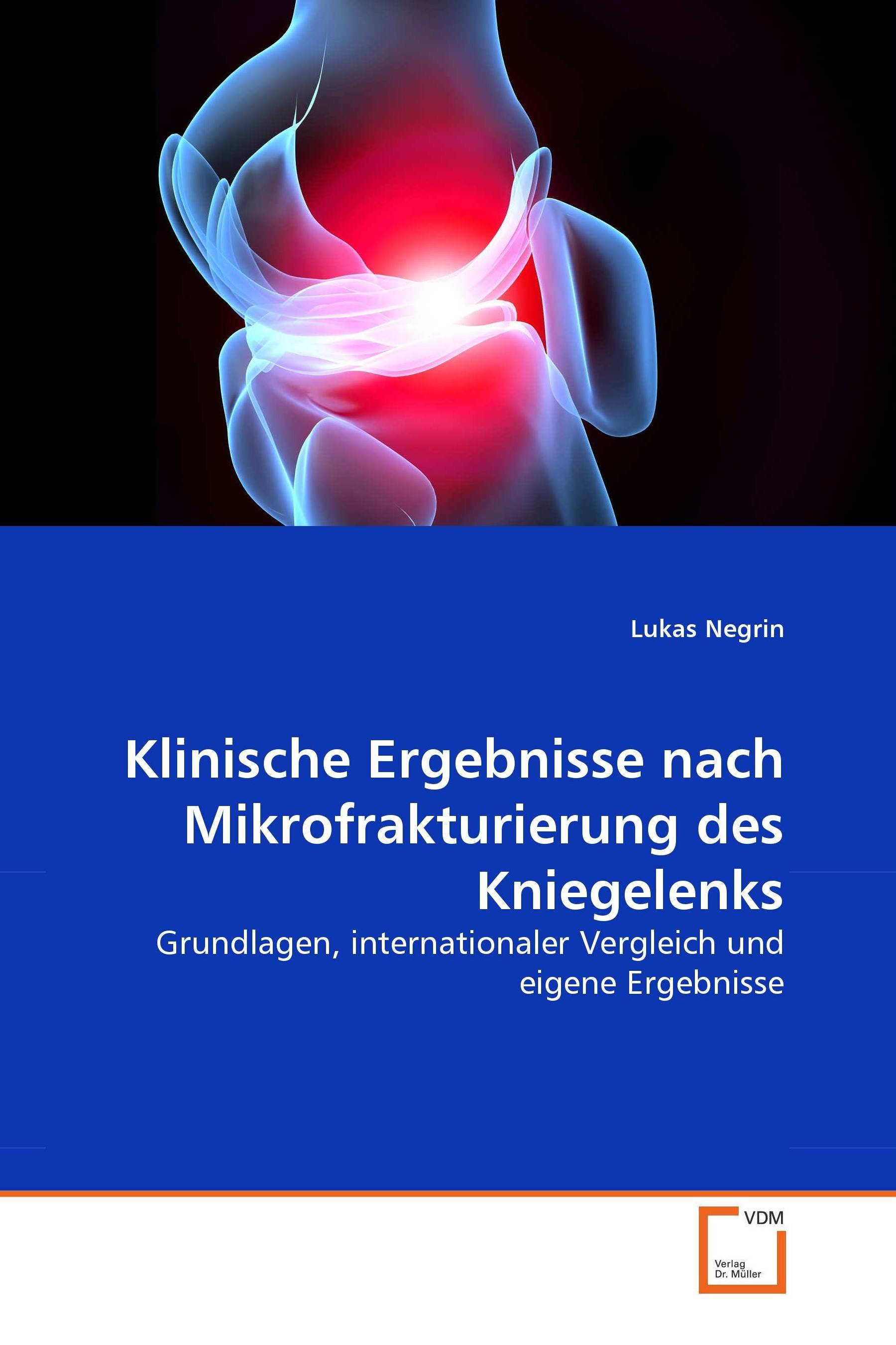 Klinische Ergebnisse nach Mikrofrakturierung des Kniegelenks EBook
