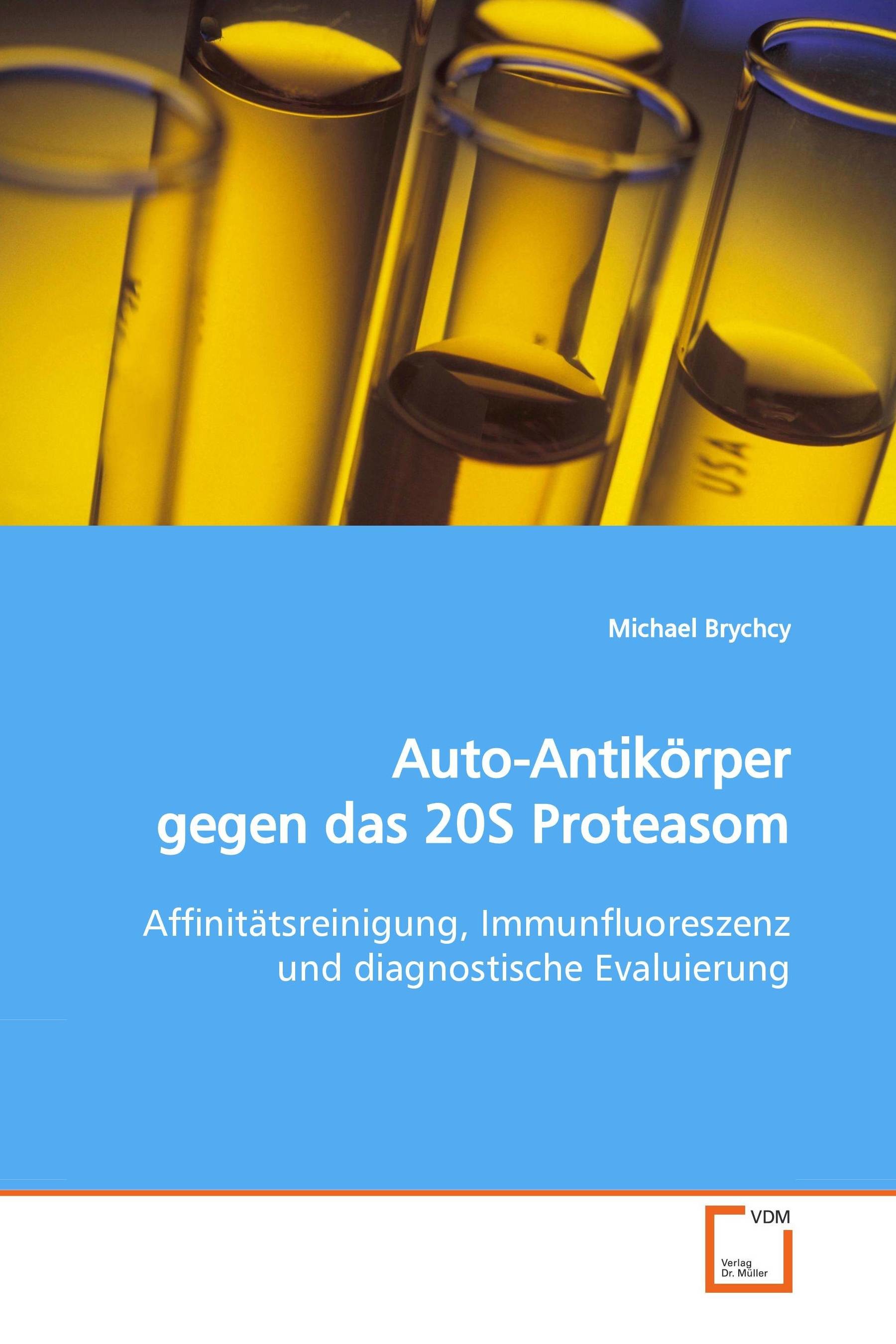 Cover Auto-Antikörper gegen das 20S Proteasom