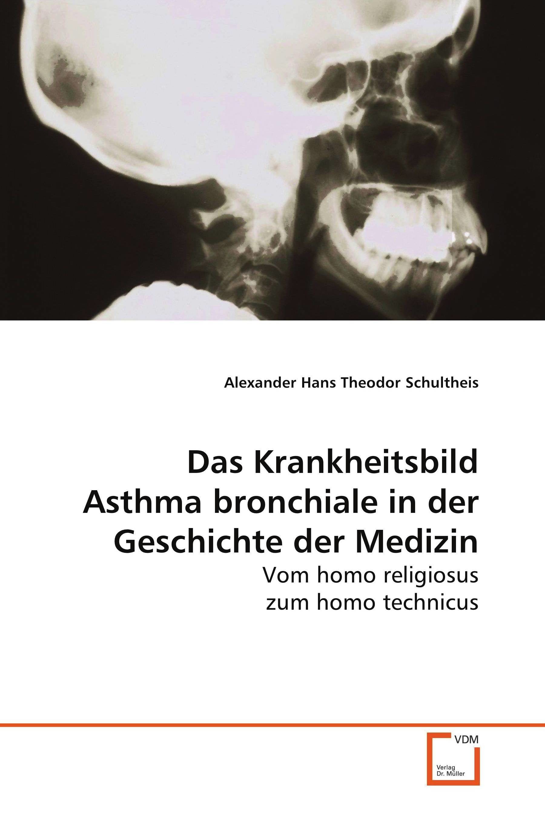 Das Krankheitsbild Asthma bronchiale in der Geschichte der Medizin