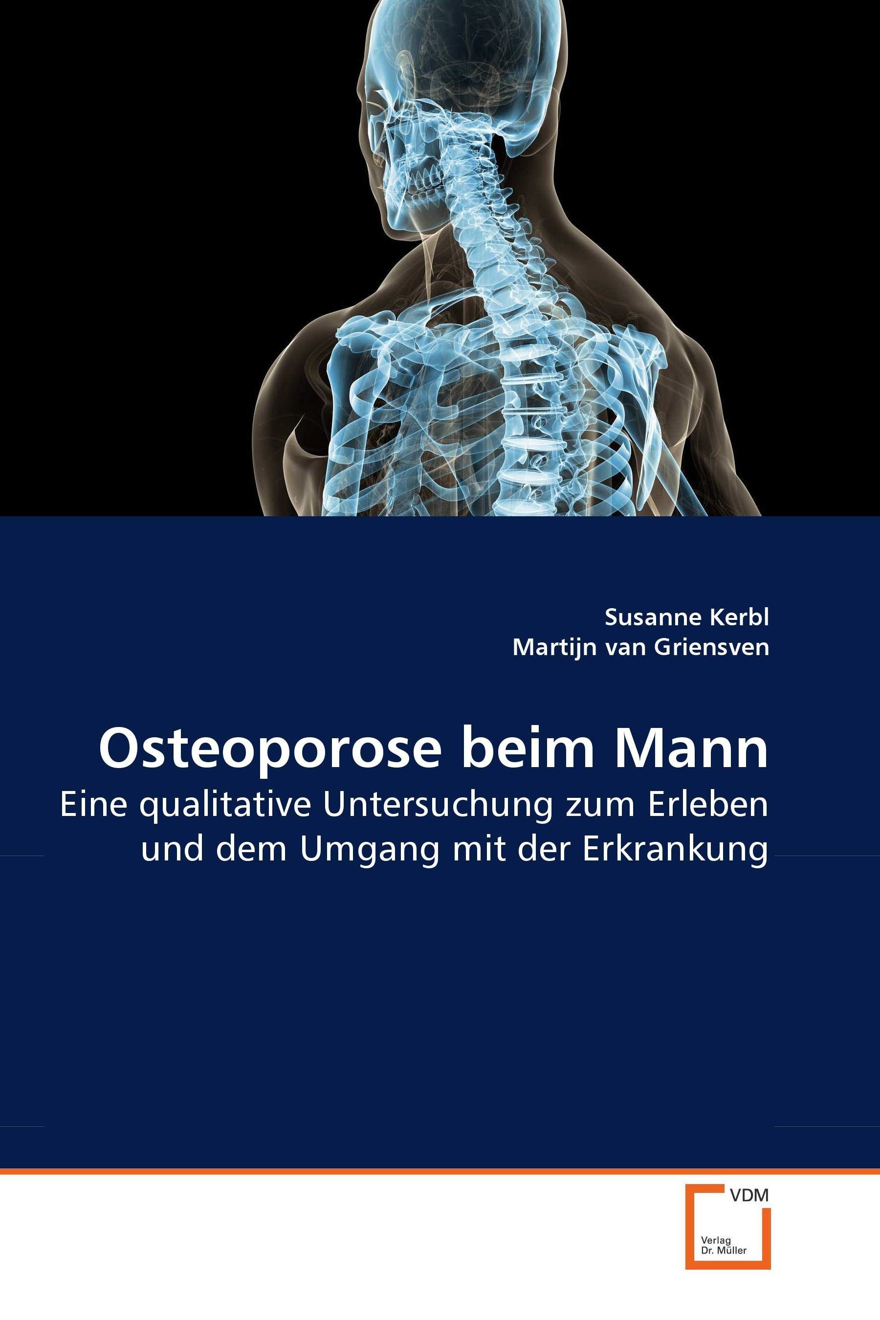 Cover Osteoporose beim Mann