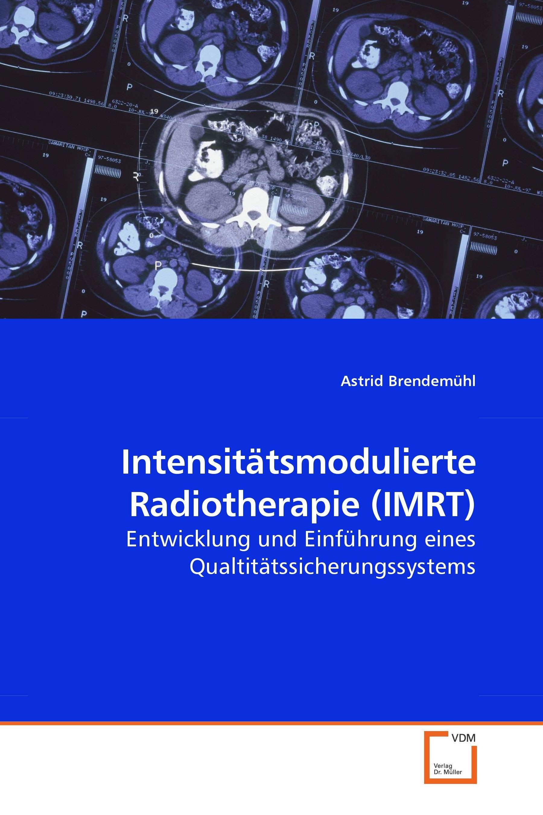 Cover Intensitätsmodulierte Radiotherapie (IMRT)