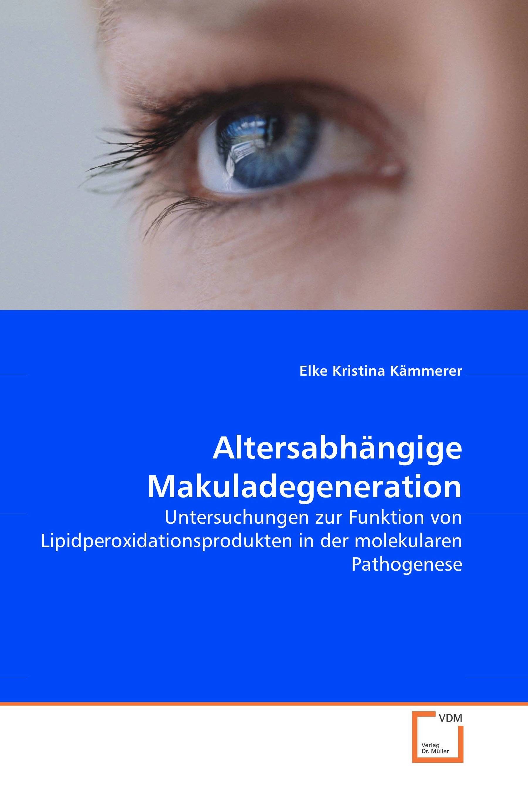 Cover Altersabhängige Makuladegeneration