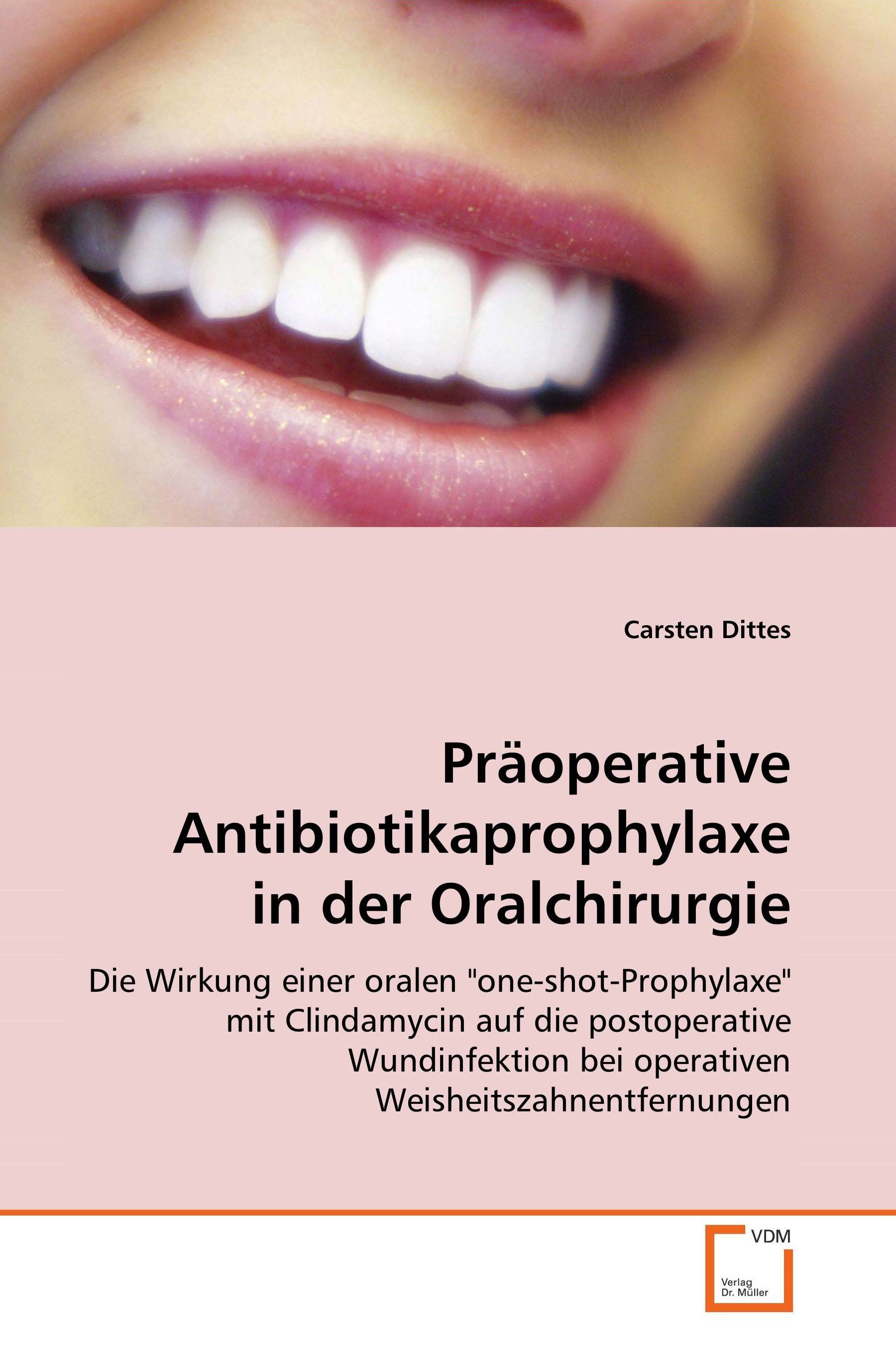 Cover Präoperative Antibiotikaprophylaxe in derOralchirurgie