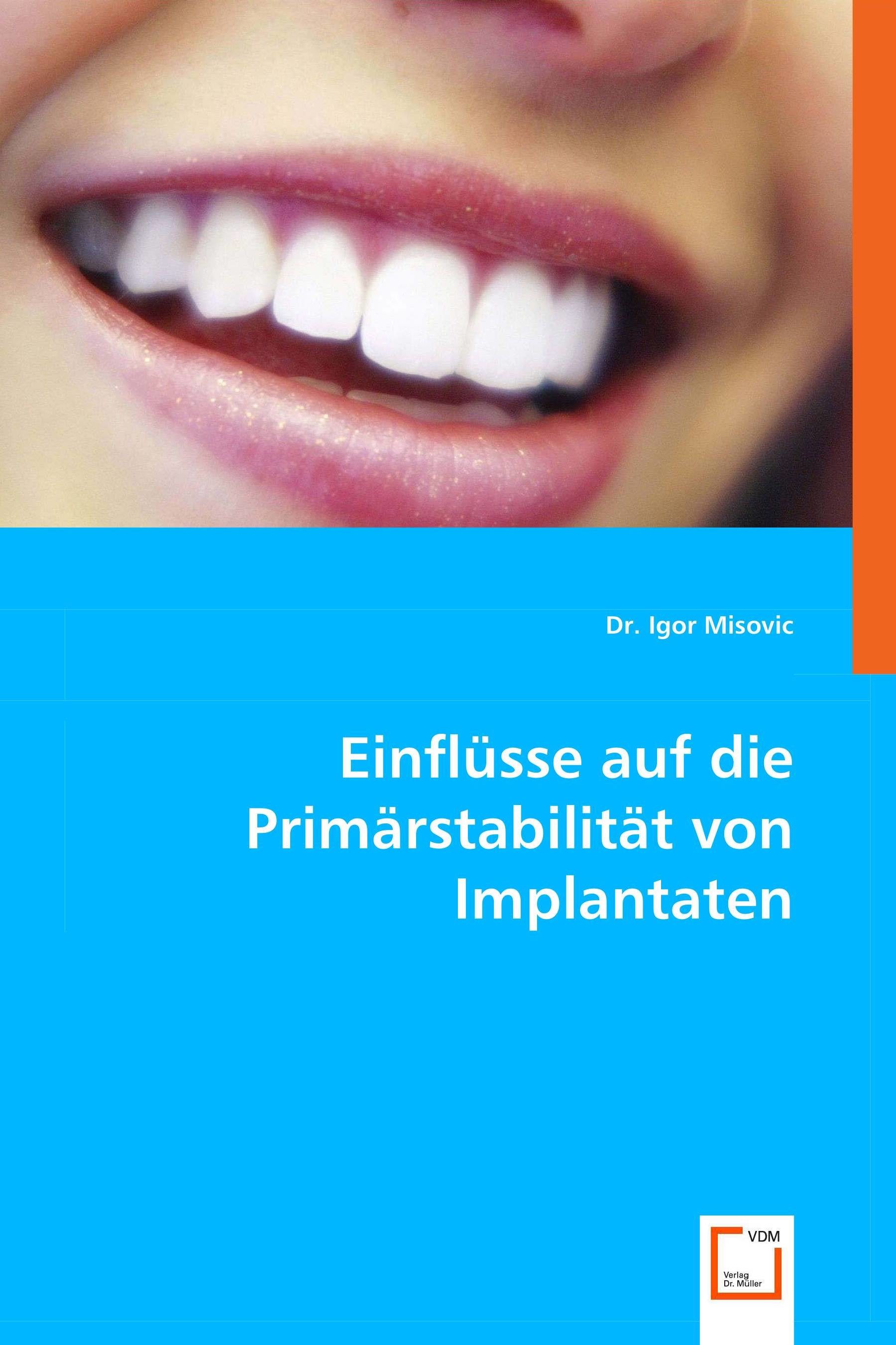 Einflüsse auf die Primärstabilität von Implantaten