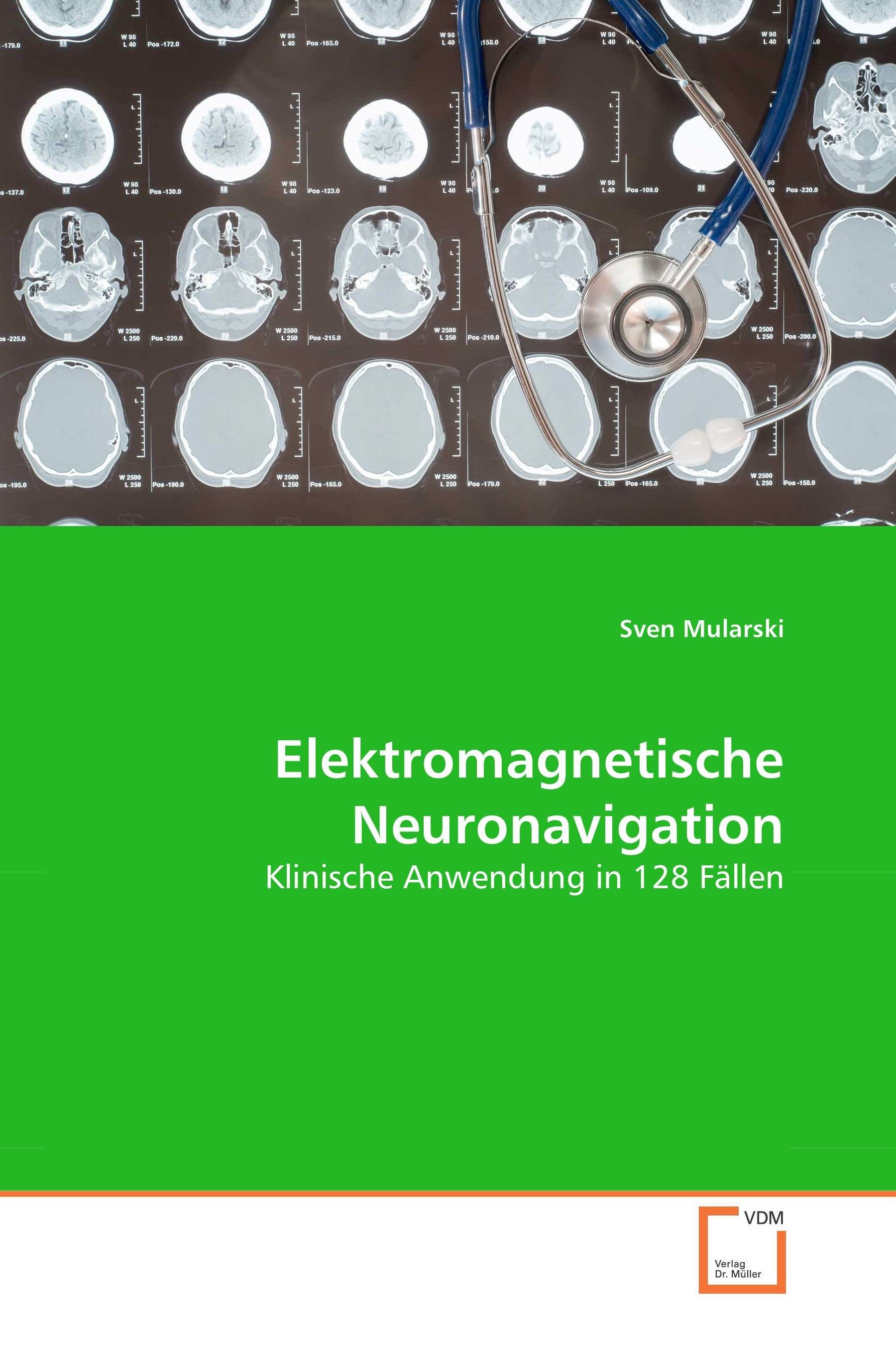 Cover Elektromagnetische Neuronavigation