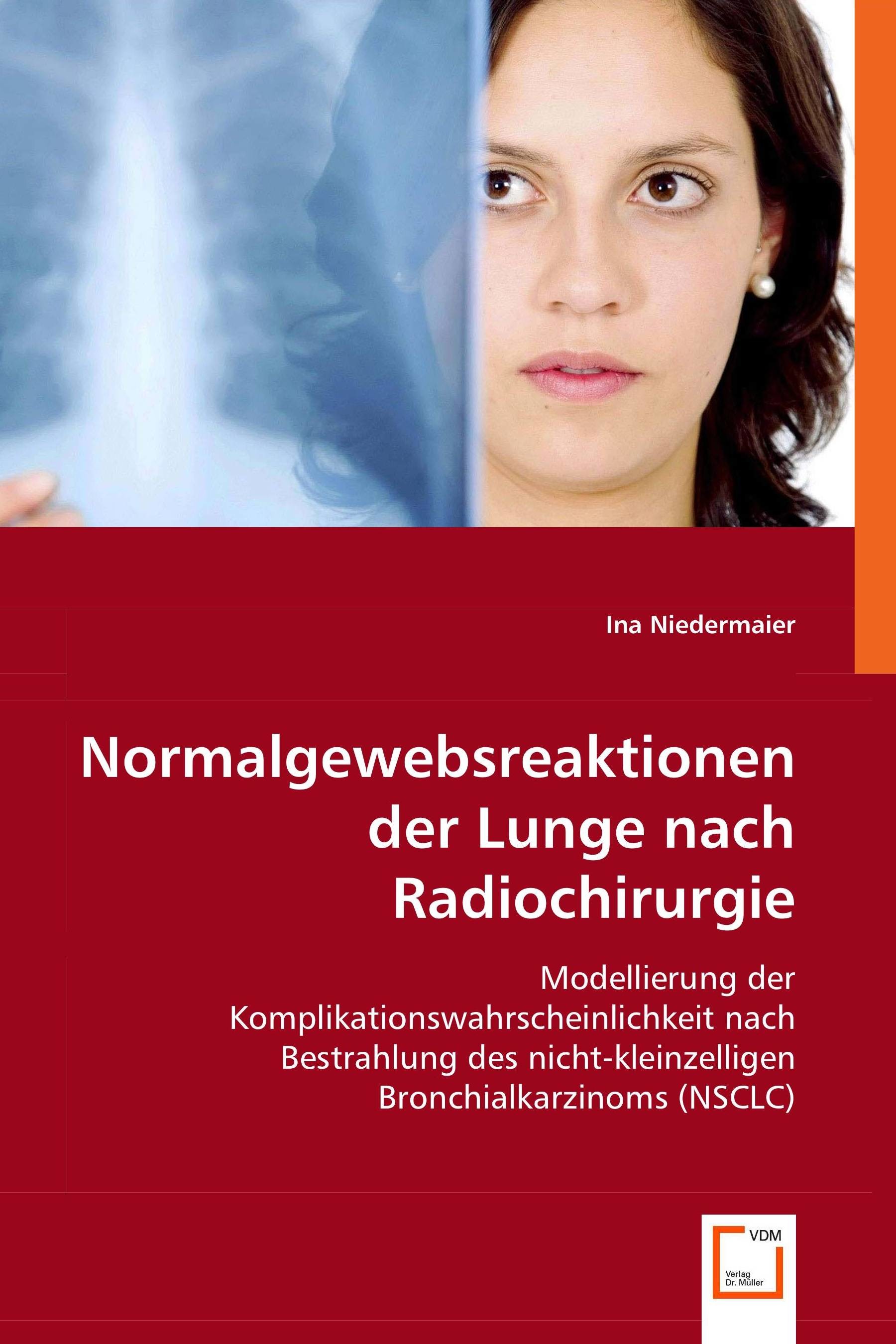 Cover Normalgewebsreaktionen der Lunge nach Radiochirurgie