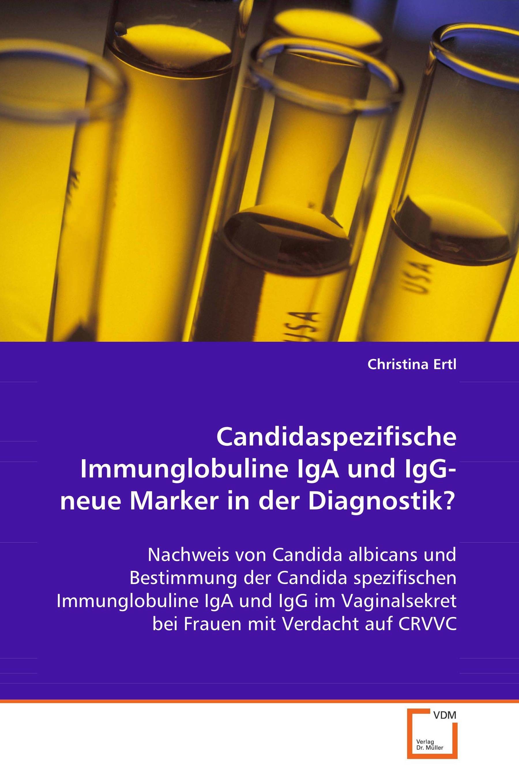 Cover Candidaspezifische Immunglobuline IgA und IgG- neueMarker in der Diagnostik?