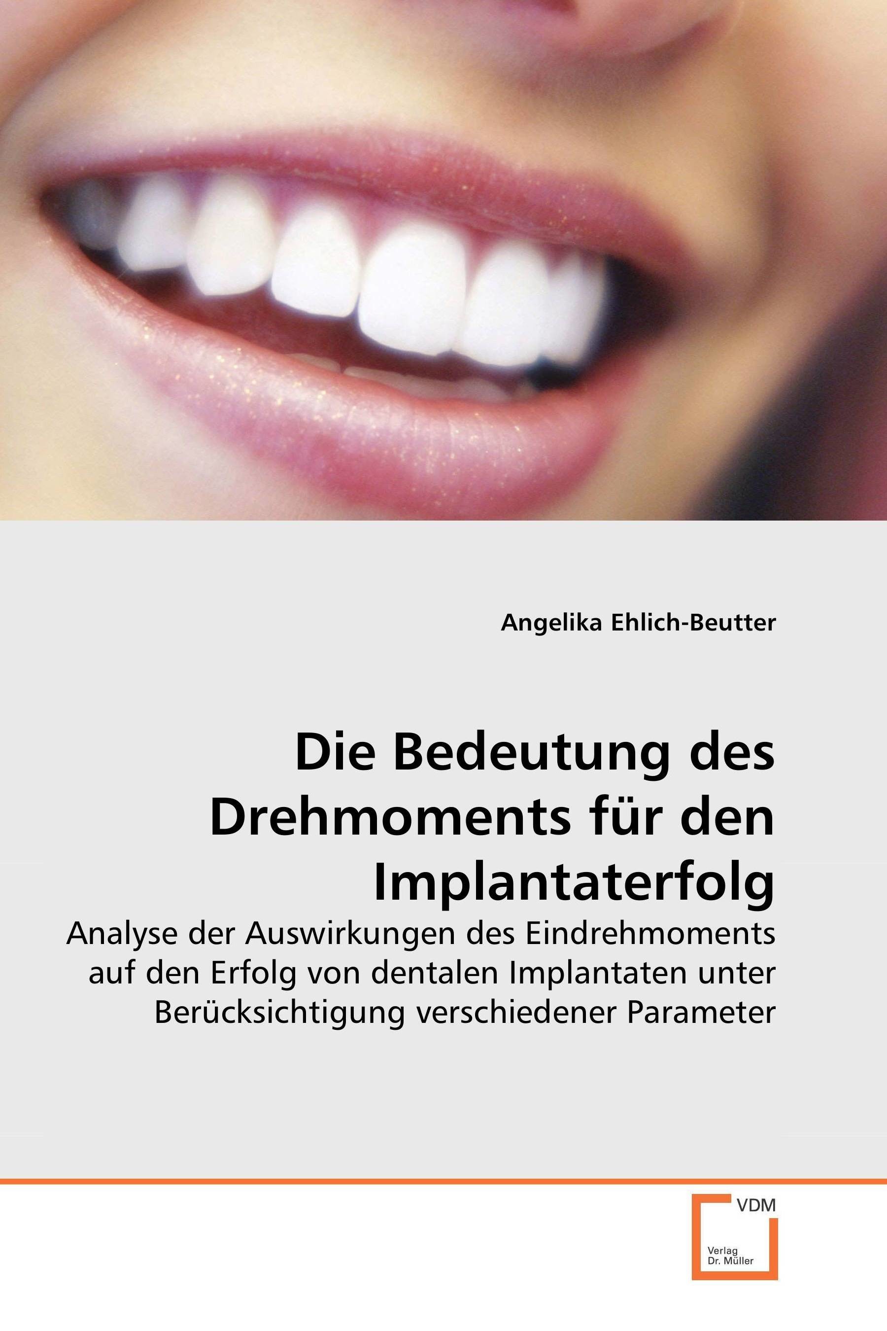 Die Bedeutung des Drehmoments für den Implantaterfolg