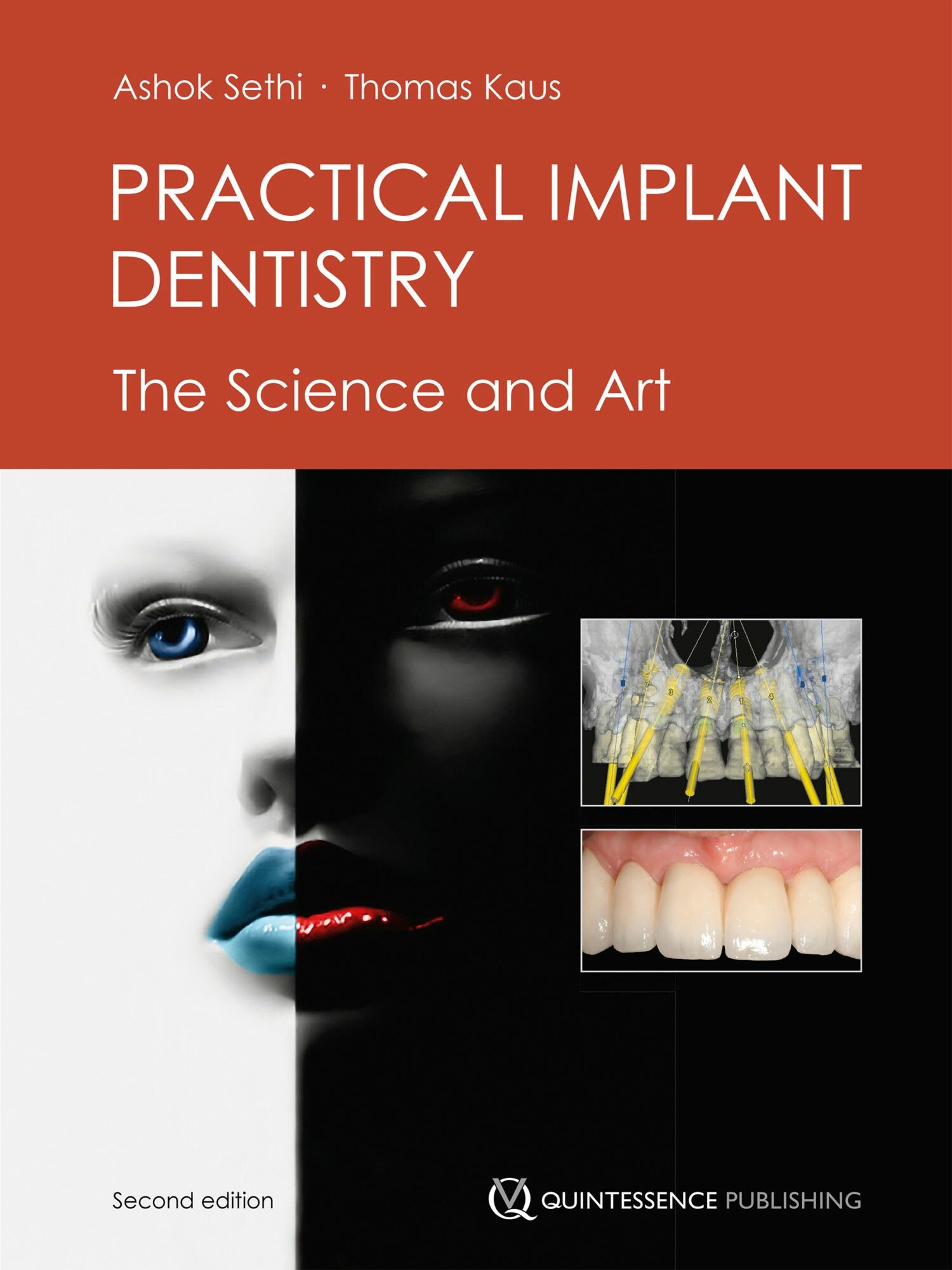 Cover Practical Implant Dentistry