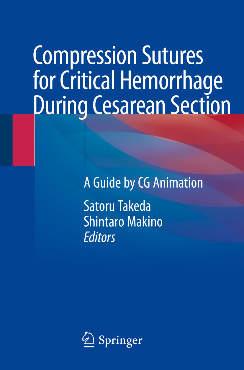 Cover Compression Sutures for Critical Hemorrhage During Cesarean Section