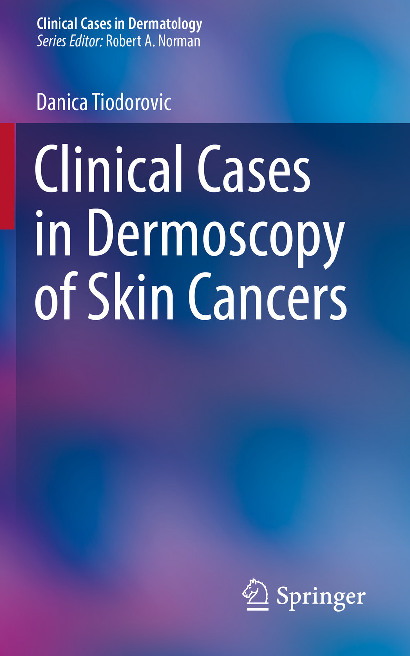 Cover Clinical Cases in Dermoscopy of Skin Cancers