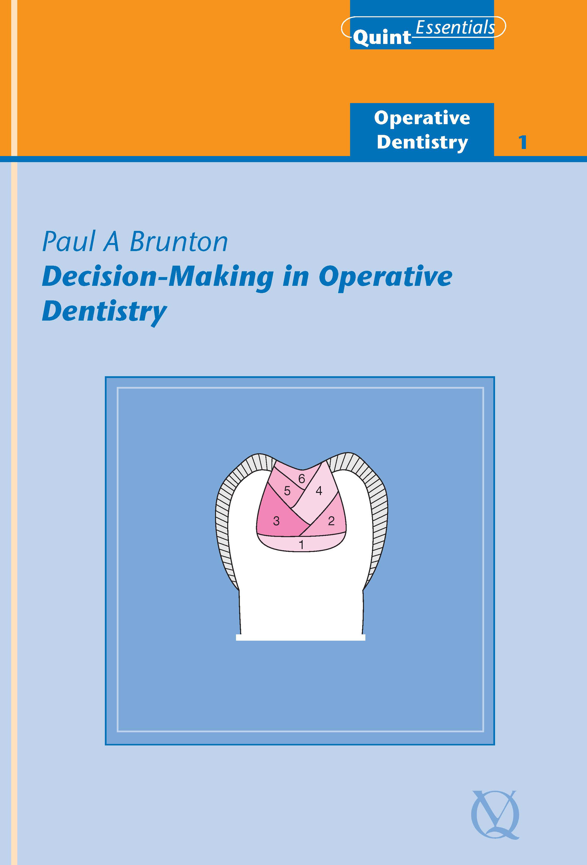 Cover Decision-Making in Operative Dentistry