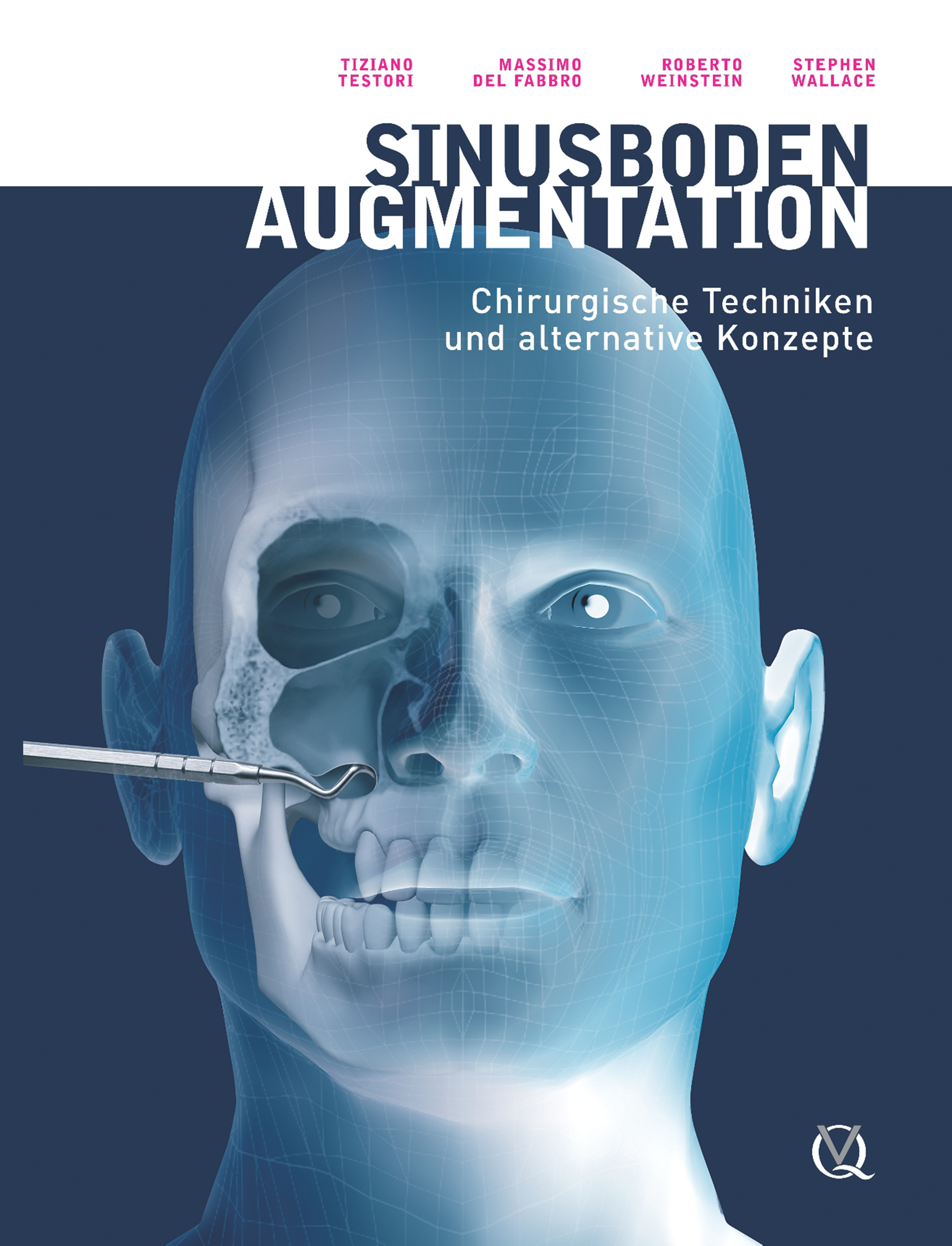 Cover Sinusbodenaugmentation
