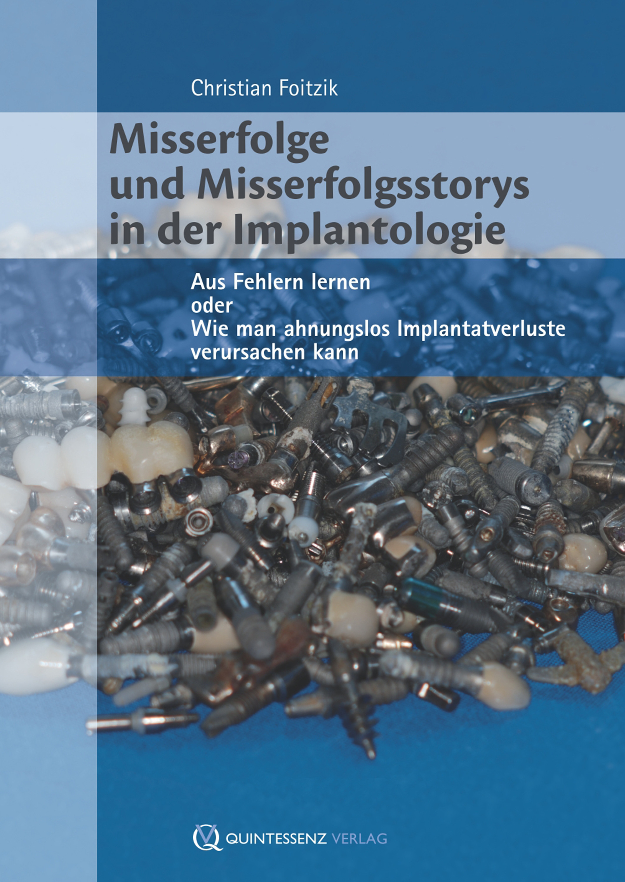 Cover Misserfolge und Misserfolgsstorys in der Implantologie