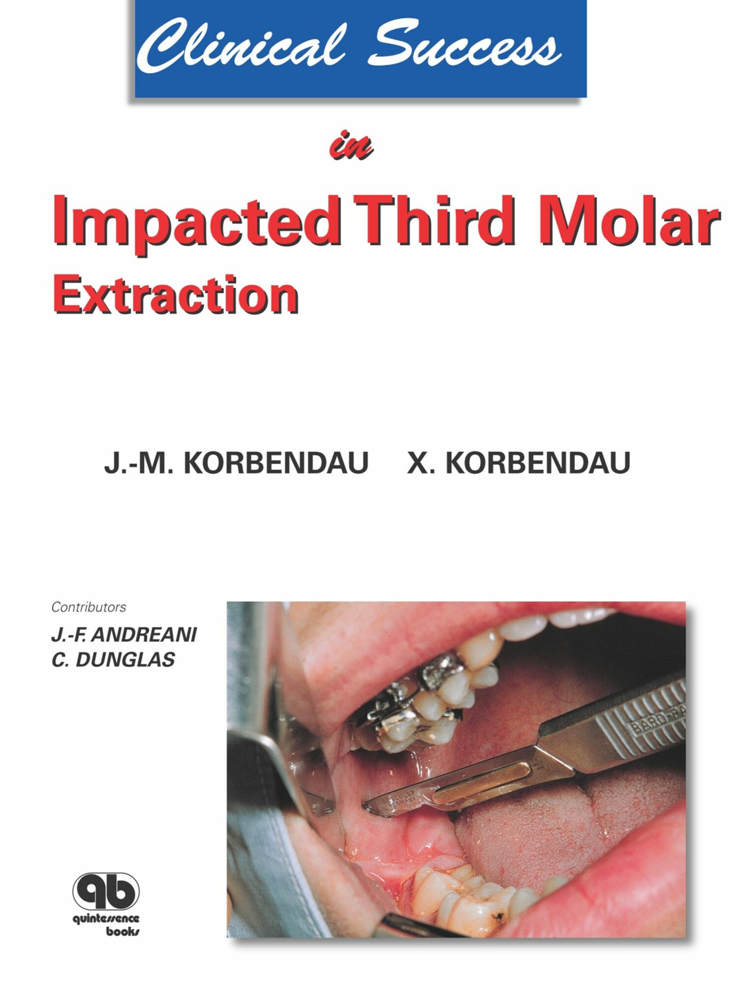 Cover Clinical Success in Impacted Third Molar Extraction