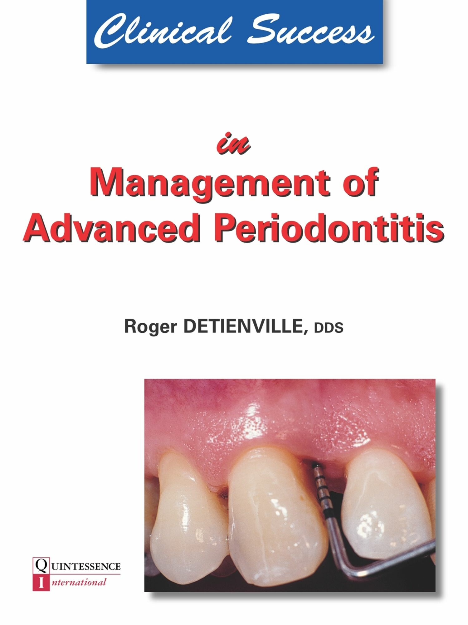 Cover Clinical Success in Management of Advanced Periodontitis
