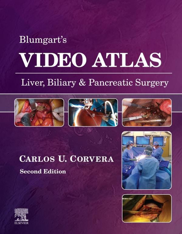 Blumgart's Video Atlas: Liver, Biliary & Pancreatic Surgery E-Book