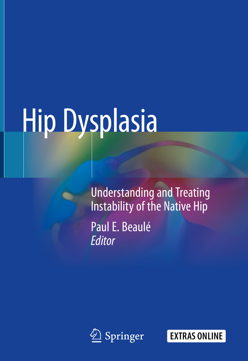 Cover Hip Dysplasia
