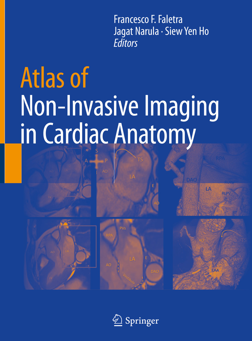 Cover Atlas of Non-Invasive Imaging in Cardiac Anatomy