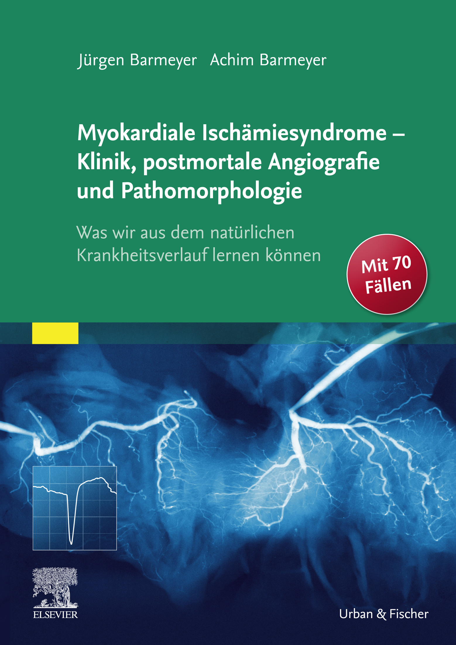Cover Die myokardialen Ischämiesyndrome - Klinik und postmortale Pathomorphologie