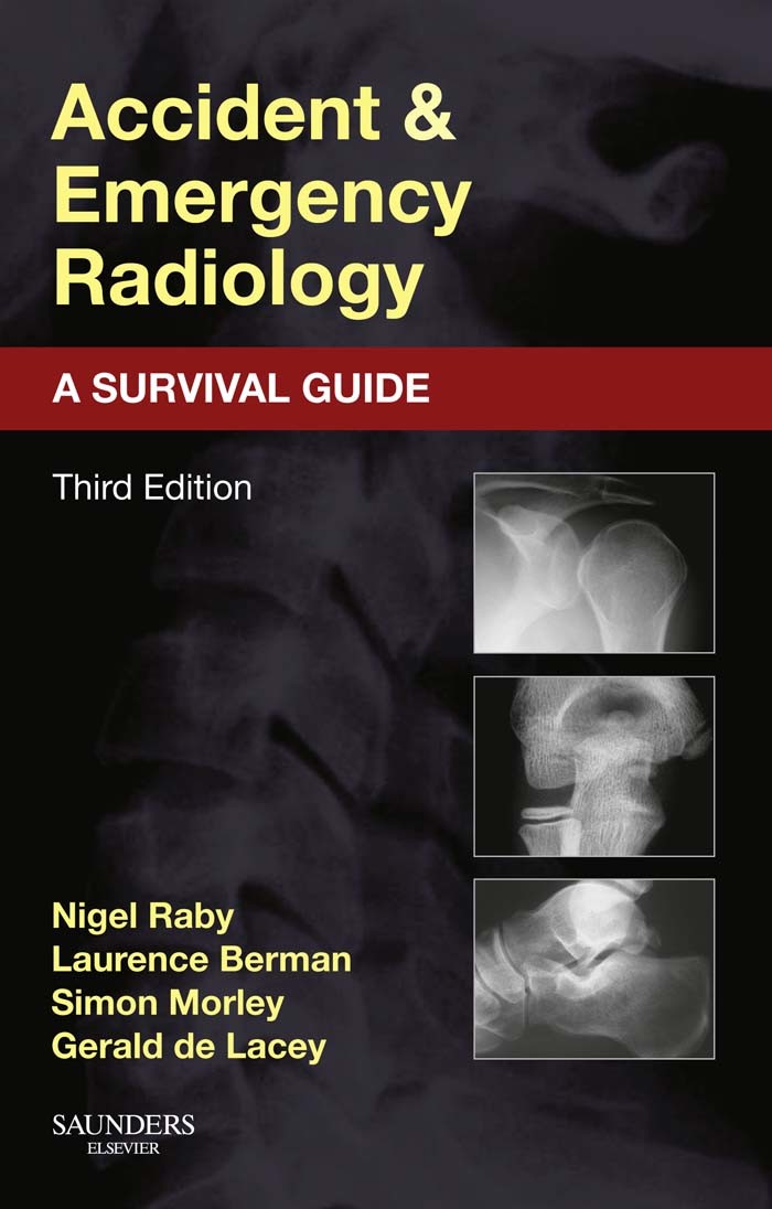 Accident and Emergency Radiology: A Survival Guide E-Book