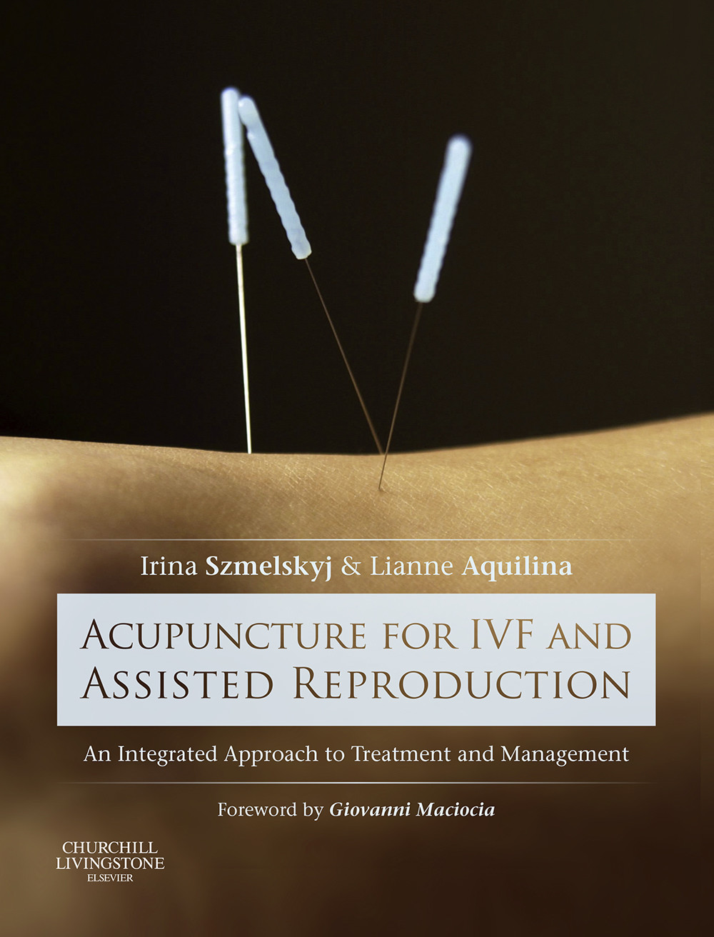 Acupuncture for IVF and Assisted Reproduction - E-Book