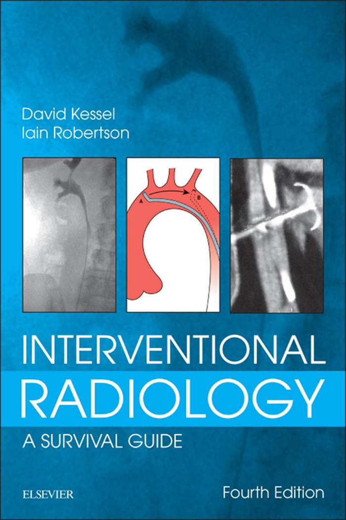 Cover Interventional Radiology: A Survival Guide E-Book