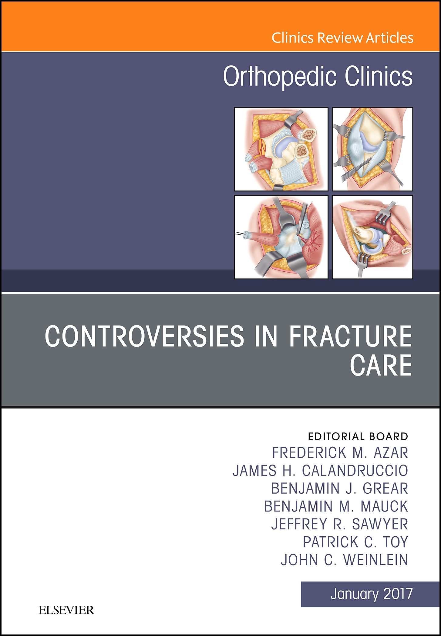 Cover Controversies in Fracture Care, An Issue of Orthopedic Clinics, E-Book