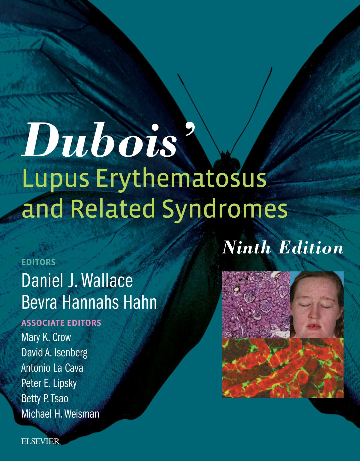 Dubois' Lupus Erythematosus and Related Syndromes - E-Book