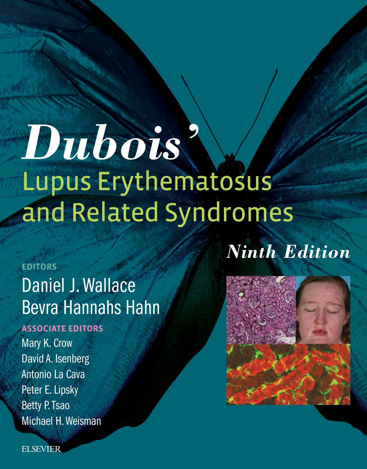 Cover Dubois' Lupus Erythematosus and Related Syndromes - E-Book