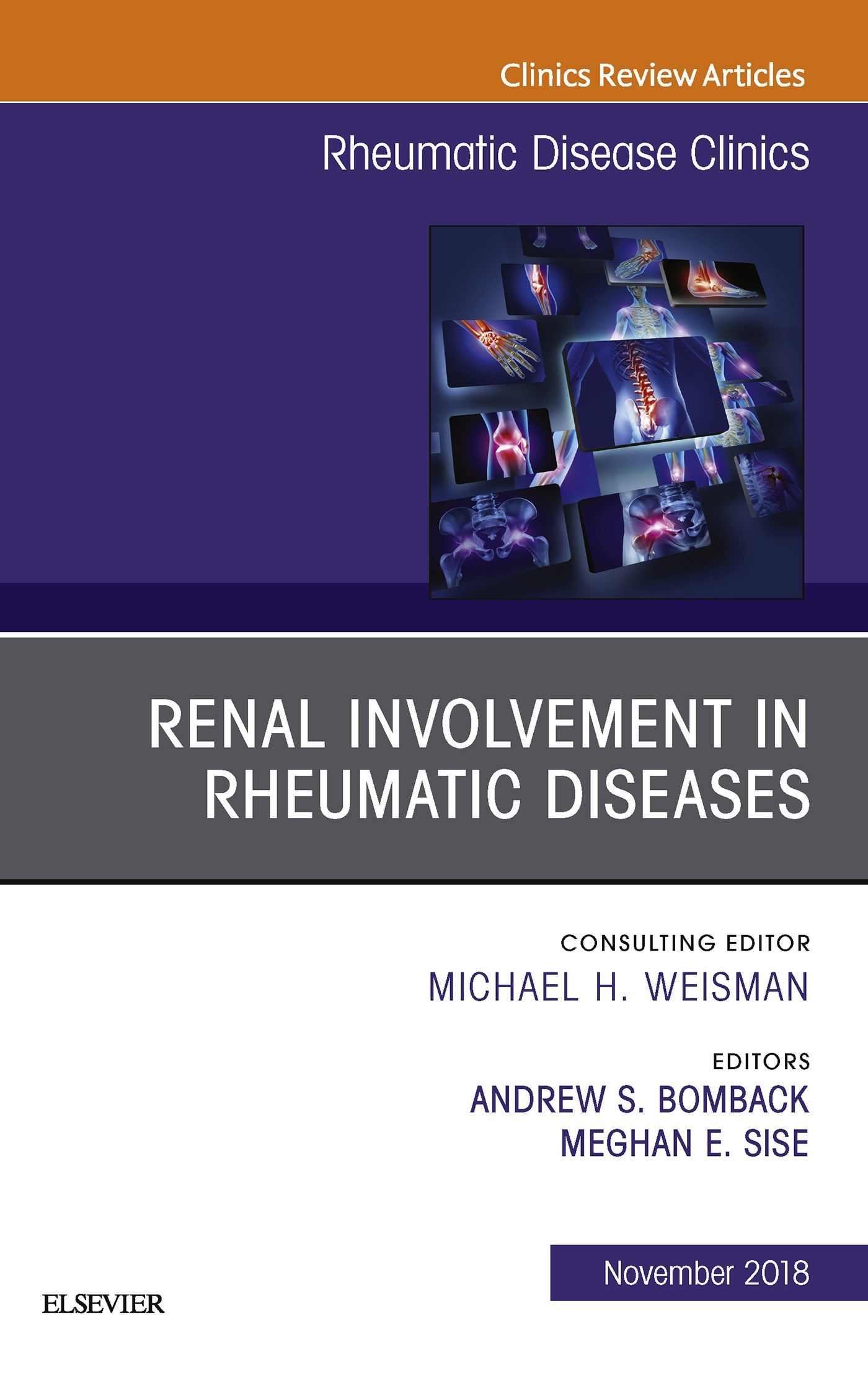 Renal Involvement in Rheumatic Diseases , An Issue of Rheumatic Disease Clinics of North America E-Book