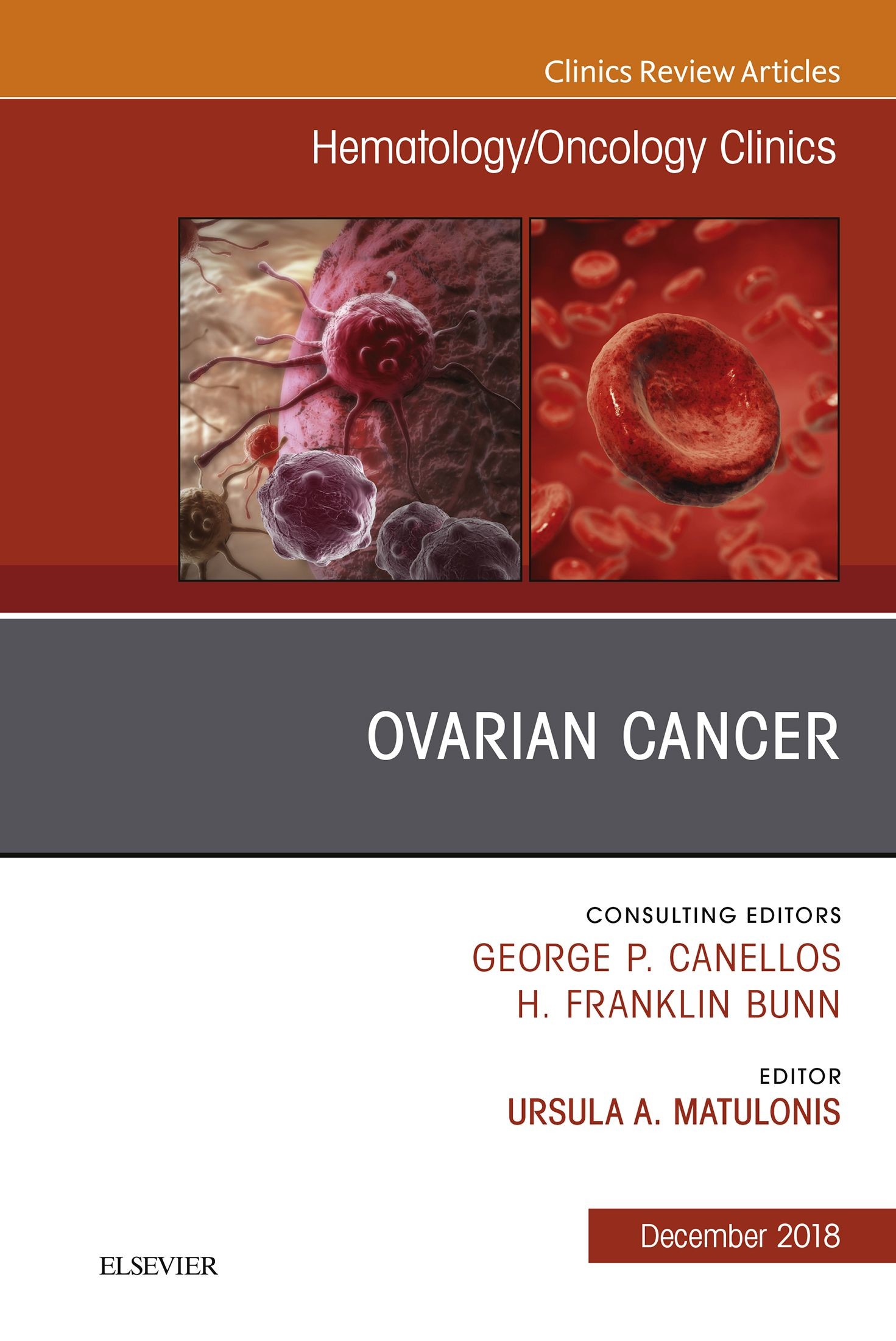 Ovarian Cancer, An Issue of Hematology/Oncology Clinics of North America E-Book