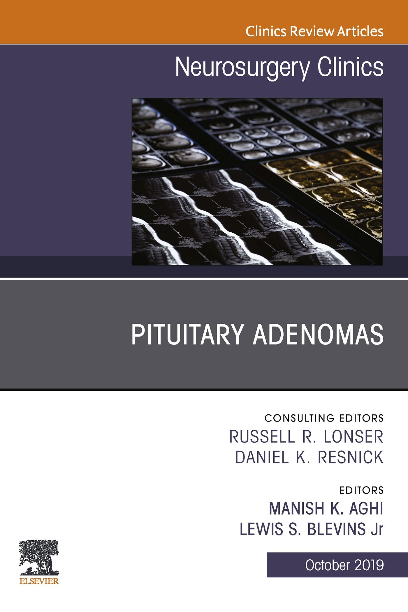Cover Pituitary Adenoma, An Issue of Neurosurgery Clinics of North America E-Book
