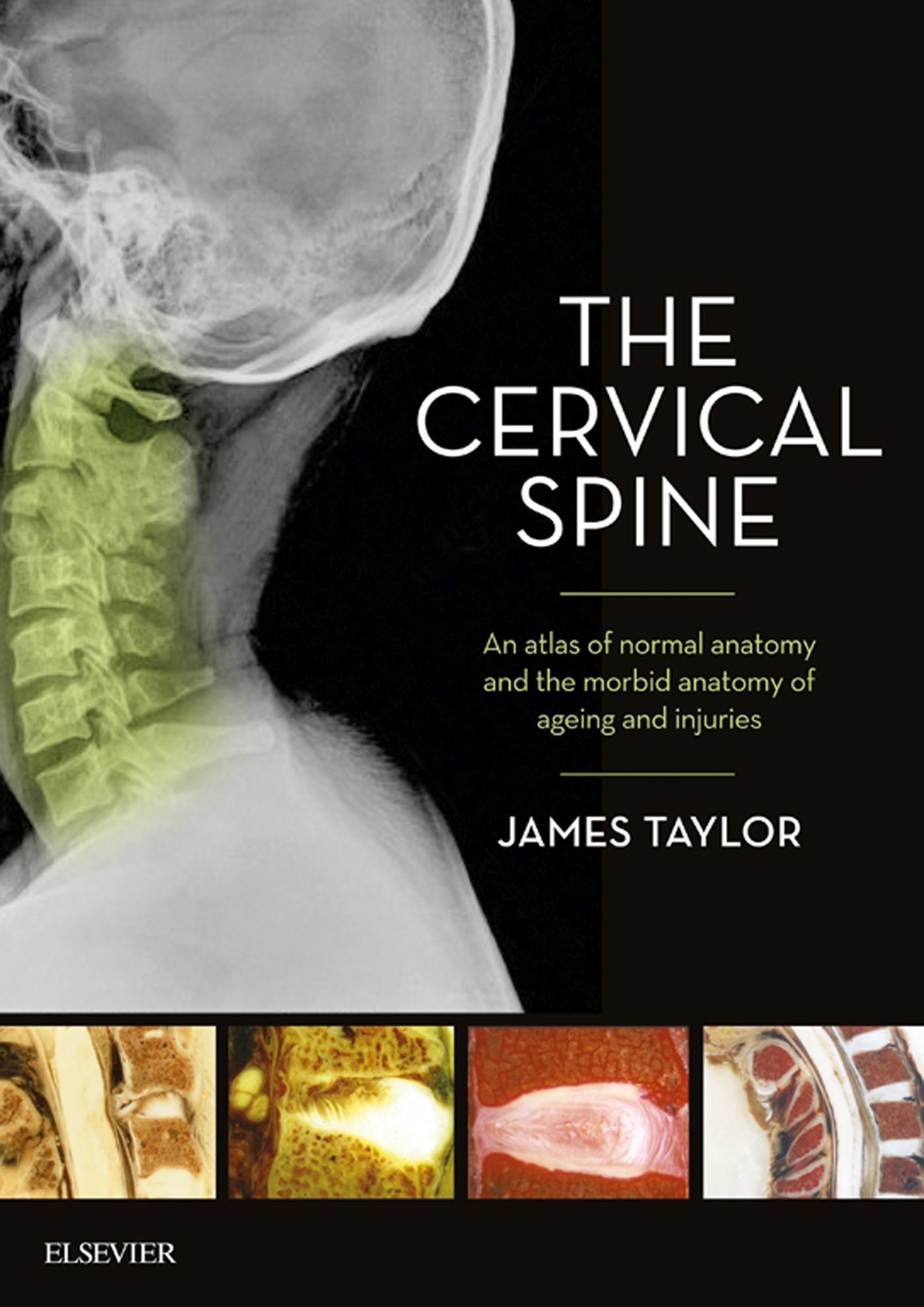 Cover The Cervical Spine