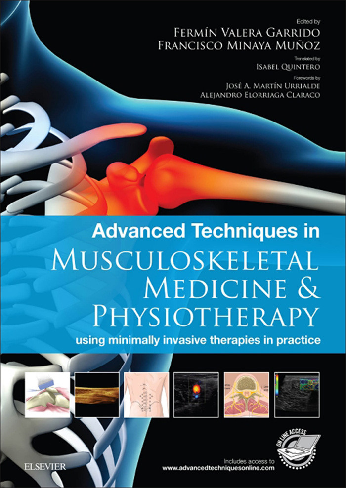 Cover Advanced Techniques in Musculoskeletal Medicine & Physiotherapy - E-Book
